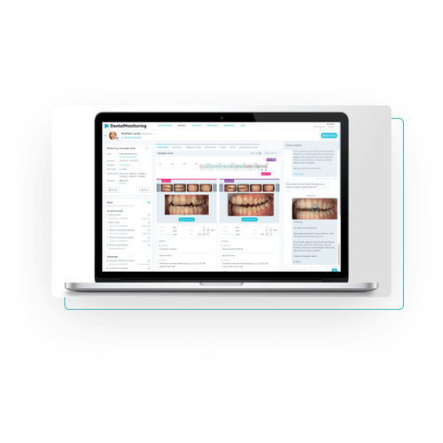 Платформа искуственного интеллекта для стоматологии - Dental Monitoring - для анализа изображений / для обработки / для захвата