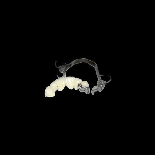 Зубной мост из керамики - Shenzhen Alcadent Co.Ltd Alcadent Dental Laboratory - резцы нижней челюсти / неподвижный
