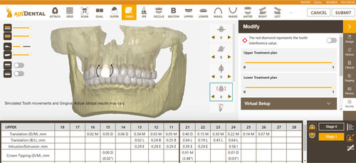 «облачные» вычисления для обработки снимков зубов - AIrDental - Inteware Co., Ltd