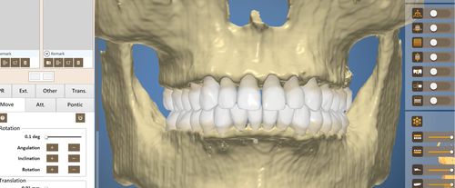 Программное обеспечение для стоматологии - OrthoAnalysis - Inteware Co., Ltd - для анализа / для обработки / для планирования лечения