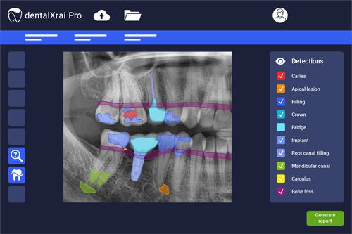 Программное обеспечение для анализа - dentalXrai Pro 3.0 - dentalXrai GmbH - для оценки / медицинское / для стоматологии
