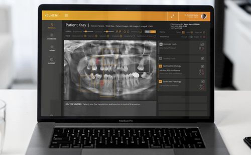 Платформа искуственного интеллекта для медицинских снимков - Second Dentist ™ - VELMENI - медицинской / для стоматологии / для анализа