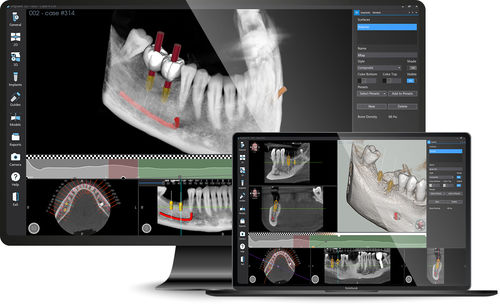 Программное обеспечение для разработки - Implant 3D - MediaLab - для 3D моделирования / для контроля / медицинское