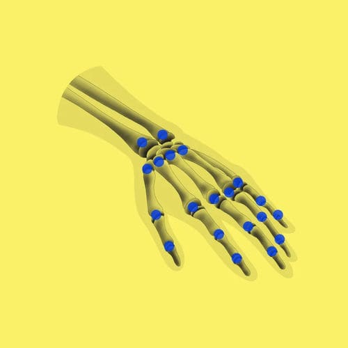 Медицинское программное обеспечение - BoneAge - Gleamer - клиническое / педиатрическое / кости