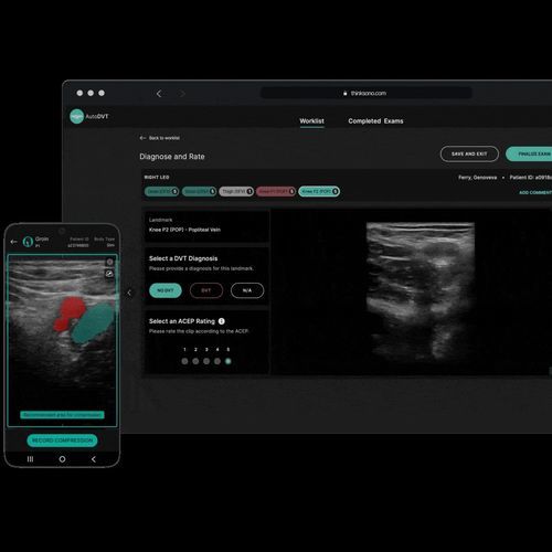 Учебное программное обеспечение - ThinkSono - для ультразвуковых исследований
