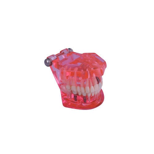 Анатомическая модель десен - #A26 - CavoMed / 3D Dental - прорезывание зубов / корневого канала / для болезней зубов