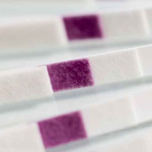 Тест-полоска для заболеваний почек - GBR-3409 - Golden BioTechnologies - аденозинмонофосфат / для мочи / для поверхности