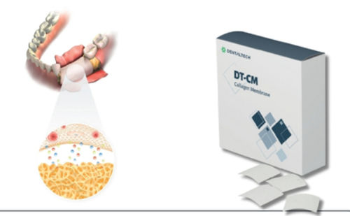 Тканевая матрица стоматологическая хирургия - DT-CM - DENTAL TECH S.R.L. - коллагена / рассасывающаяся