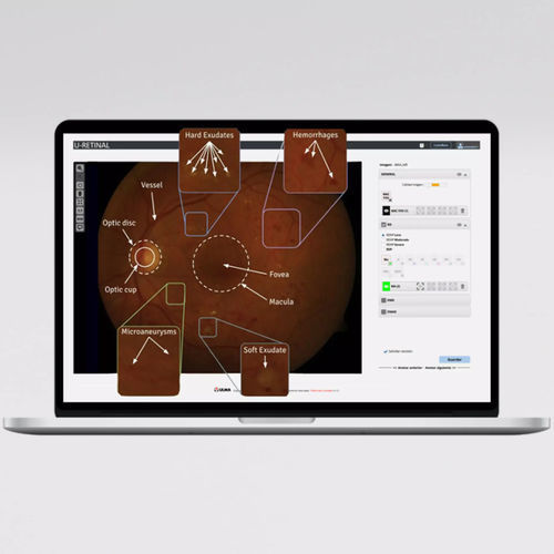 Платформа искуственного интеллекта для офтальмологии - UMI DR - ULMA Medical Technologies - для диагностики / для диагностики