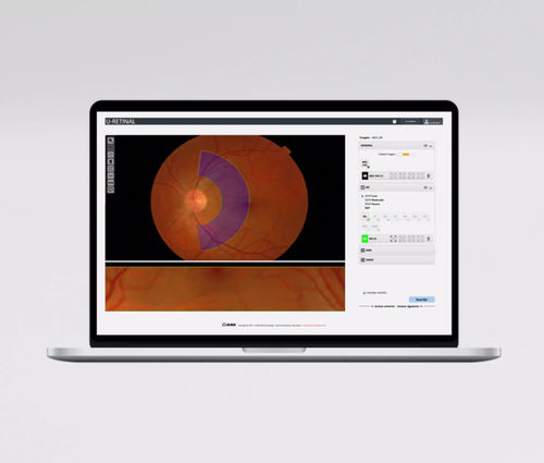 Модуль программного обеспечения для измерений - UMI AVR - ULMA Medical Technologies - для офтальмологии / сетчатой оболочки / артерии