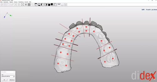 Программное обеспечение для захвата - didex  - Dentona AG - для печати 3D / для моделирования / для производственного процесса