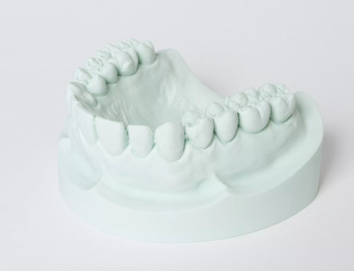 Стоматологический материал из гипса - hydro-stone® 200 - Dentona AG - из камня / литьевой / для моделирования