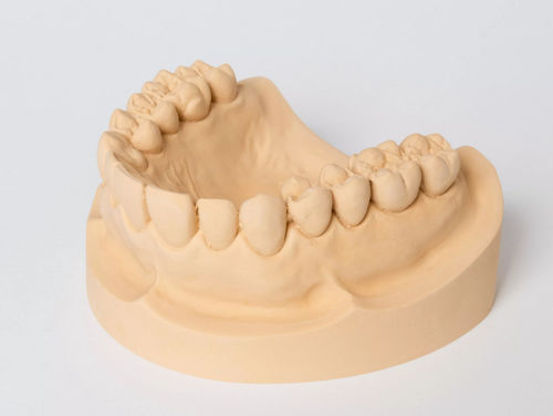 Стоматологический материал из камня - rapid - Dentona AG - для оттискных ложек / для изготовления зубных протезов / для моделирования