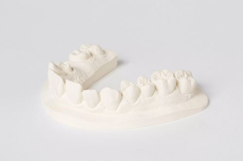 Стоматологический материал из камня - esthetic-base® B.C.  - Dentona AG - для оттискных ложек / для моделирования