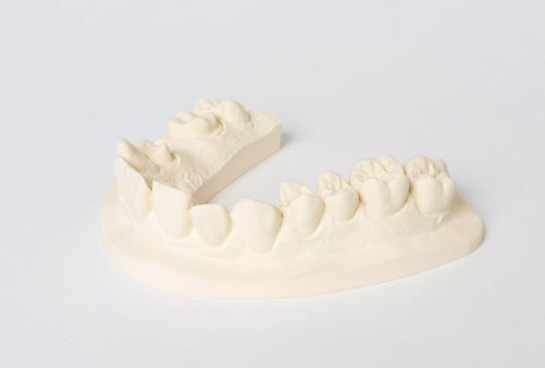Стоматологический материал из камня - No. 1 - Dentona AG - для стоматологической лаборатории / для моделирования