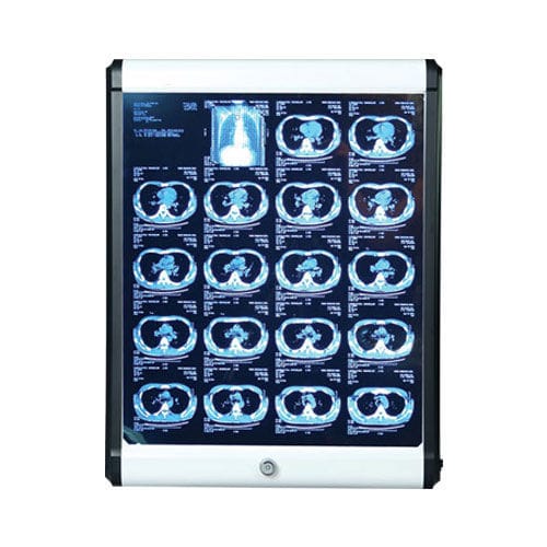 Негатоскоп 1 диапазон - SSMEC-VB-100 - Samsung Medi Engineering
