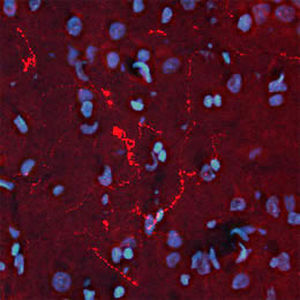 Реактив для бета-эндорфина - RA21004 - Neuromics - поликлональное антитело / IgG / для научных исследований