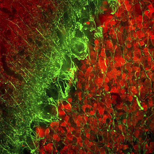 Реактив для альфа-интернексина - MO22154 - Neuromics - моноклональное антитело / IgG / для научных исследований