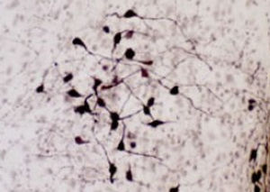 Реактив окситоцин - RA24604 - Neuromics - антитела / сыворотки / для иммуногистохимии
