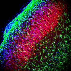 Реактив IgG - RA25034 - Neuromics - для вестерн-блоттинга / для иммуногистохимии / жидкость