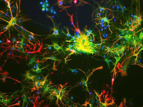 Реактив моноклональное антитело - MO22143 - Neuromics - для научных исследований / для вестерн-блоттинга / для иммуногистохимии