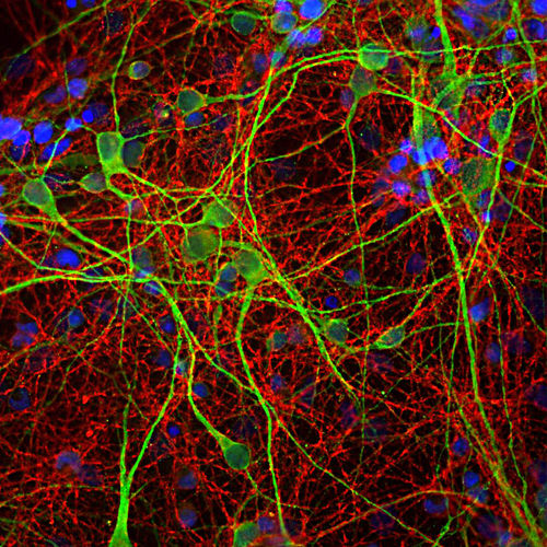 Реактив антитела - MO22170 - Neuromics - для научных исследований / для вестерн-блоттинга / для иммуногистохимии