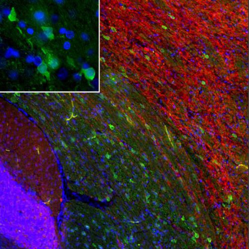 Реактив IgG - MO22196 - Neuromics - для вестерн-блоттинга / для иммунофлюоресценции / для иммуноцитохимии