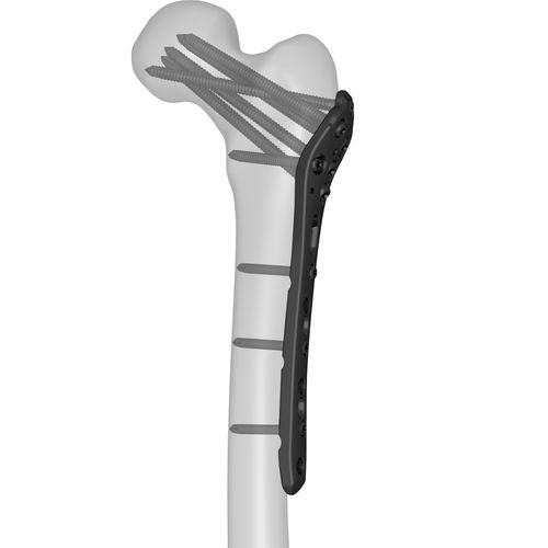 Компрессионная костная пластина бедренная кость - 301040 series - Boneunion Medical - проксимальная / блокируемая / из титана