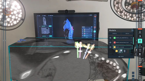 Платформа искуственного интеллекта для медицинских снимков - SurgicalAR® - MEDIVIS - для предоперационного планирования / учебная / для печати 3D