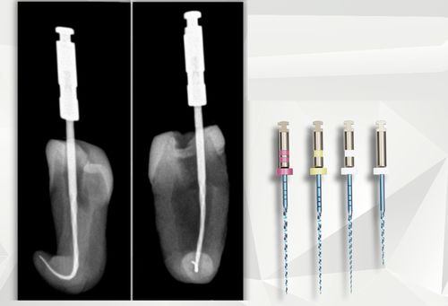 Ротационный стоматологический напильник - croot0003 - C-Root Dental Medical - для лечения корневых каналов / NiTi