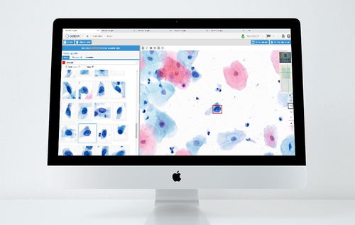 Платформа искуственного интеллекта для медицинских исследований - CYTOPROCESSOR® - DATEXIM - для лабораторий / для диагностики рака шейки матки / с данными из интернета
