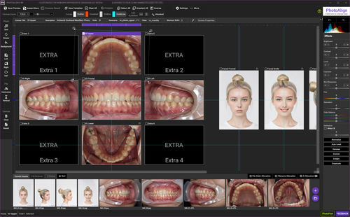 Программное обеспечение оттиска изображения - Photoalign - PhotoAlign - для анализа изображений / для управления данными / для управления данными пациента