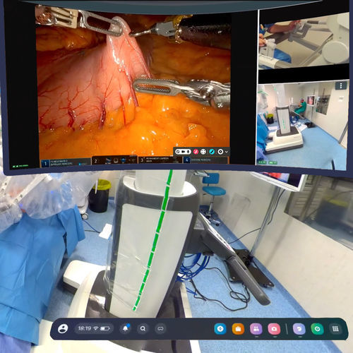 Операционная видеосистема 4K - mSurgery - mSurgery - MP4 / MPEG / AVI