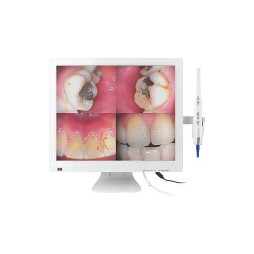 Интраоральная камера - M-978V - Chuan Fu Medical Instrument Co., Ltd. - цифровая / CMOS