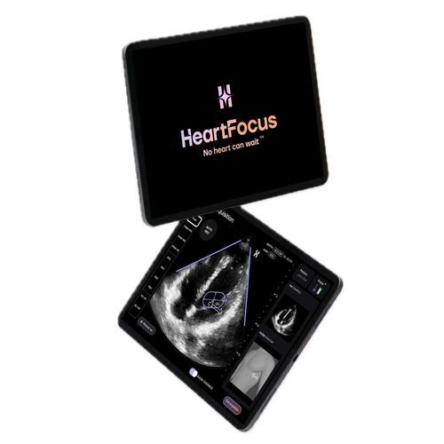 Мобильное приложение для эхокардиографии - HeartFocus - DESKI - для диагностики / для составления отчетности / для мониторинга
