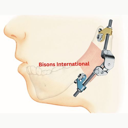 Челюстной дистрактор - BI-001477 - Bisons International - черепной / внешний