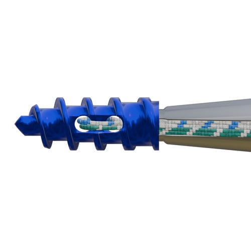 Анкерный фиксатор мелкие суставы - MiniTi™ - Ortho-Design - нерассасывающийся