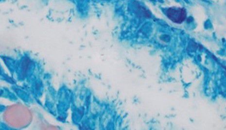 Набор реактивов краситель - Wuhan Jinhong Biotech Development Co., Ltd. - для микробиологии / бактерия Helicobacter pylori
