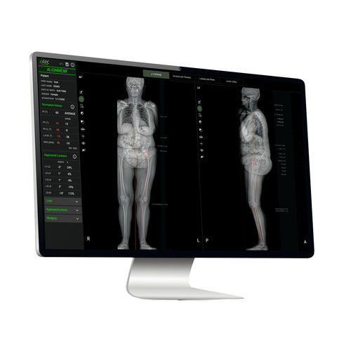 Платформа искуственного интеллекта медицинской - EOS IMAGING - для медицинских снимков / для количественной оценки / для машинного обучения