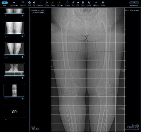 Модуль программного обеспечения для рентгенологии - Orthogrid - G-Squared - для анализа изображений / для измерений / тело