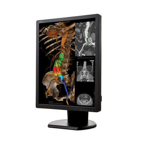 Монитор для диагностики - CX20N - Wide USA Corporation - для медицинских снимков / 21,3" / LCD