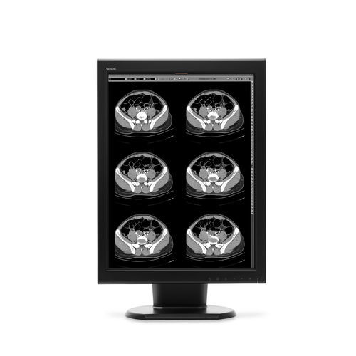 Монитор для диагностики - MX20N - Wide USA Corporation - для медицинских снимков / 21,3" / LCD