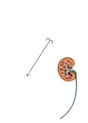 Мочеточниковый интродьюсер - FY series - Hunan Endovascular Device Co., Ltd. - почечный / направляемый / атравматический