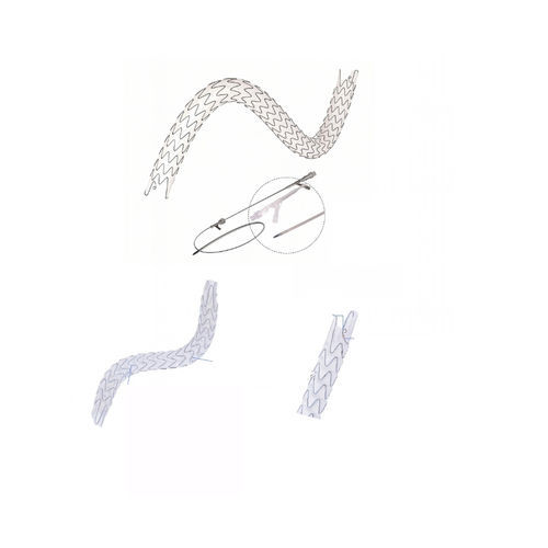 Мочеточниковый стент - EUS0919514 - Hunan Endovascular Device Co., Ltd. - из нитинола / с покрытием