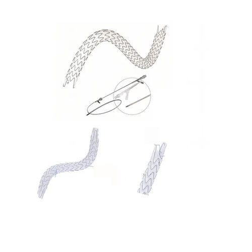 Мочеточниковый стент - EUS series - Hunan Endovascular Device Co., Ltd. - из нитинола / из полимера / саморасширяющийся