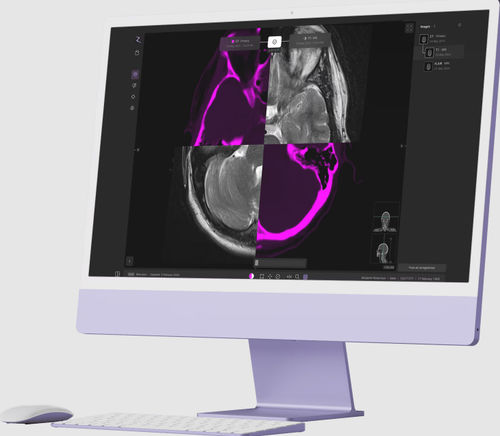 Медицинское программное обеспечение - zap-axon - ZAP Surgical Systems Inc - для разработки / для обработки / для планирования