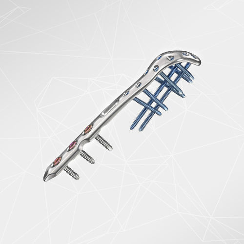 Компрессионная костная пластина для локтевого отростка - LOQTEQ® 2.7 - aap Implantate - блокируемая / металлическая