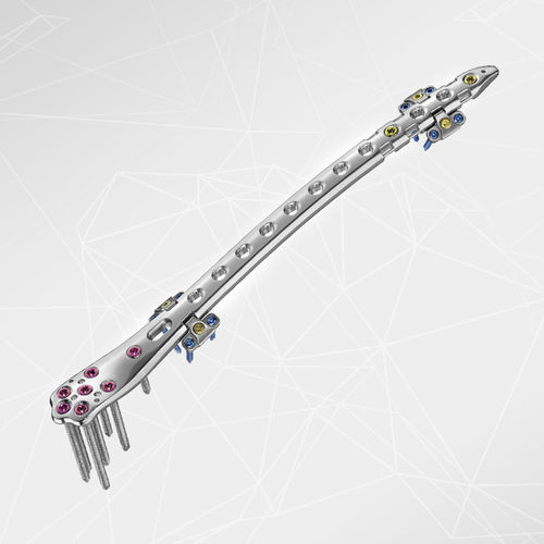 Компрессионная костная пластина для перипротезного перелома бедра - LOQTEQ®  - aap Implantate - дистальная / боковая / блокируемая