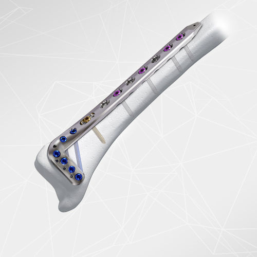 Компрессионная костная пластина большеберцовая кость -  LOQTEQ® 3.5 - aap Implantate - дистальная / переднебоковая / блокируемая