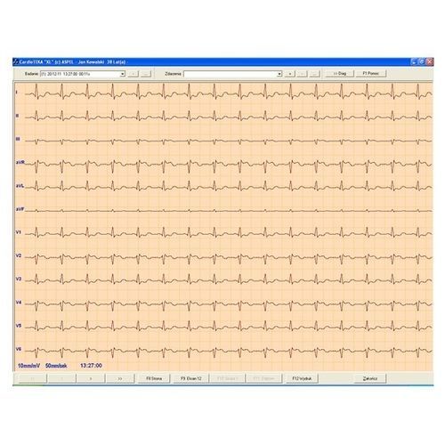 Программное обеспечение для электрокардиографии - CARDIOTEKA v.211SOFTHL7 - ASPEL  - визуализатор / сердца / подключенное